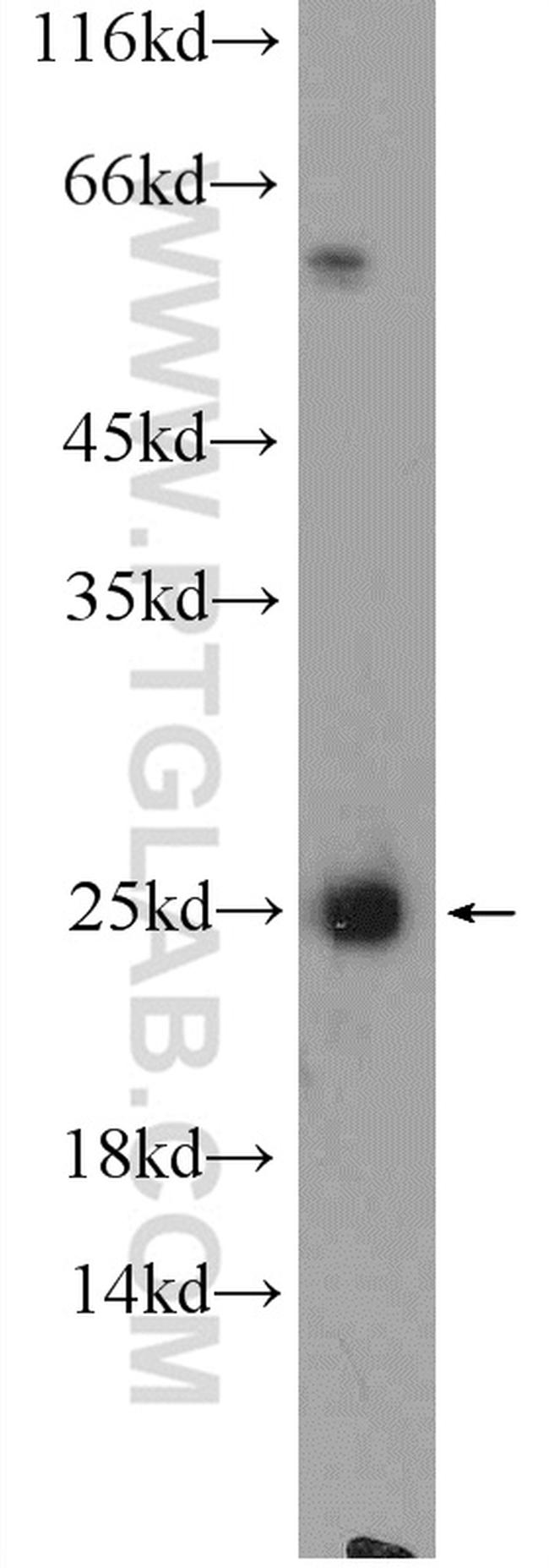 CALN1 Antibody in Western Blot (WB)