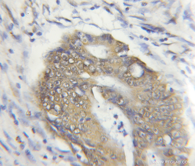 ERAL1 Antibody in Immunohistochemistry (Paraffin) (IHC (P))