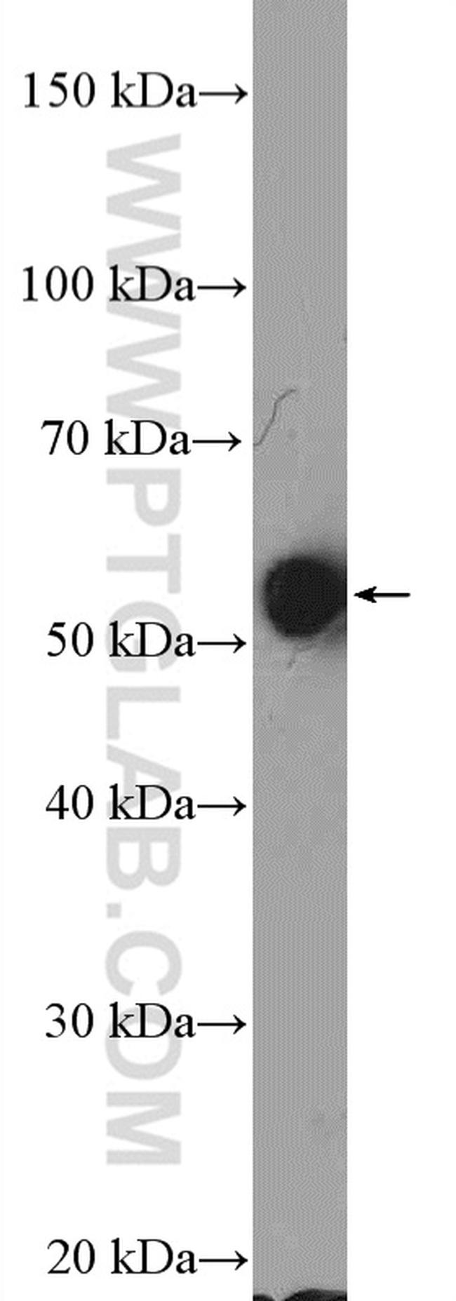 ERAL1 Antibody in Western Blot (WB)