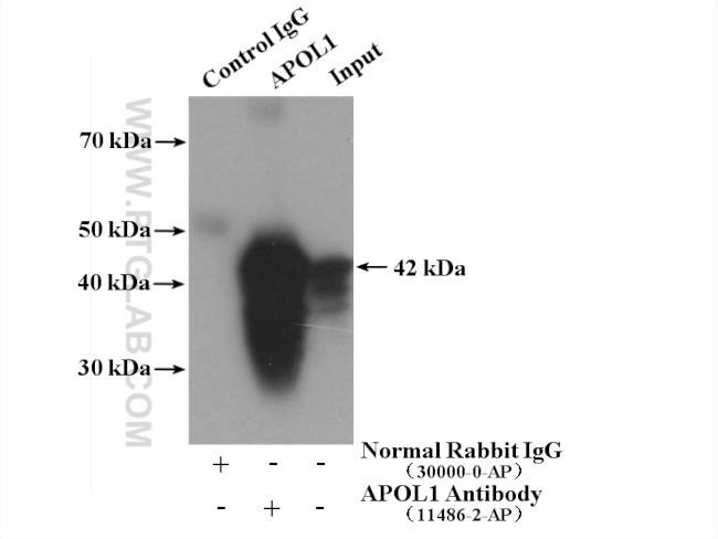 APOL1 Antibody in Immunoprecipitation (IP)