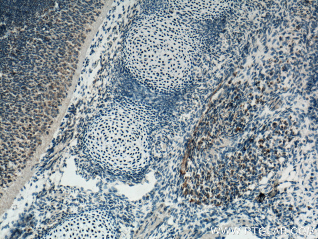 FGF18 Antibody in Immunohistochemistry (Paraffin) (IHC (P))