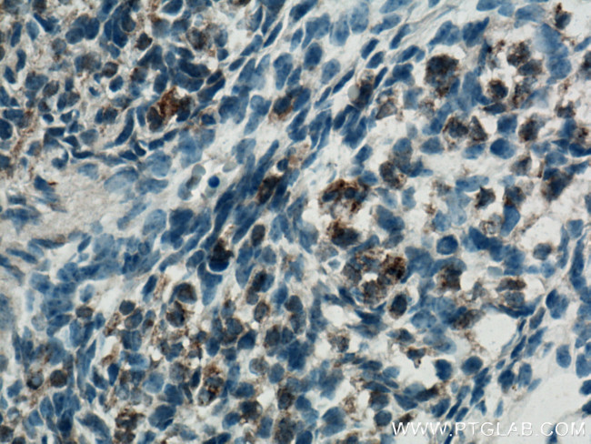 FGF18 Antibody in Immunohistochemistry (Paraffin) (IHC (P))