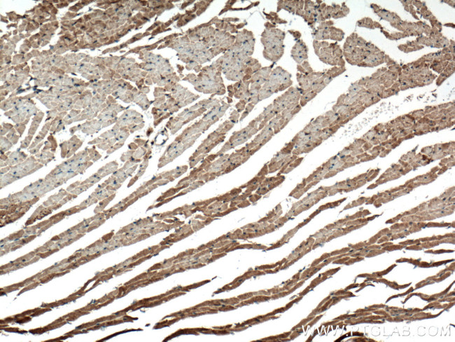 FGF18 Antibody in Immunohistochemistry (Paraffin) (IHC (P))