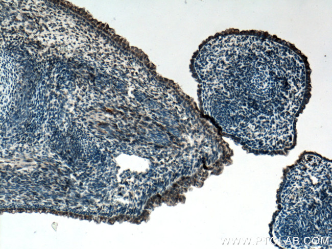 FGF18 Antibody in Immunohistochemistry (Paraffin) (IHC (P))