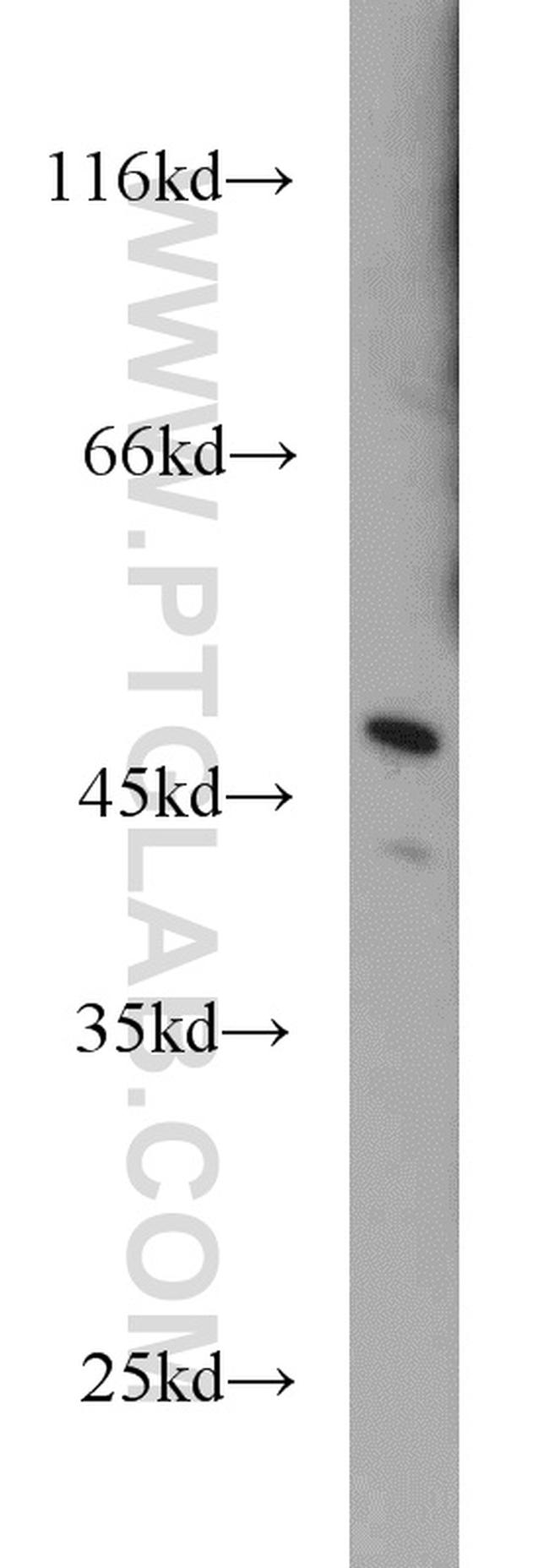 TFDP2 Antibody in Western Blot (WB)