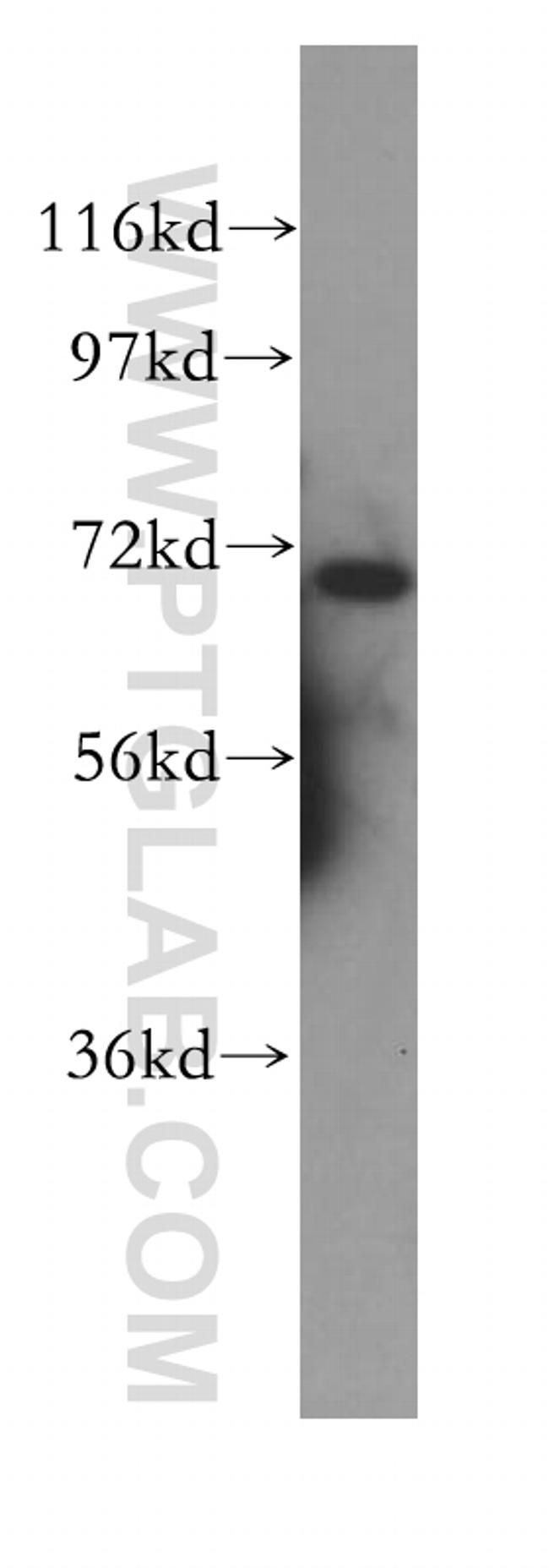 FRS2 Antibody in Western Blot (WB)