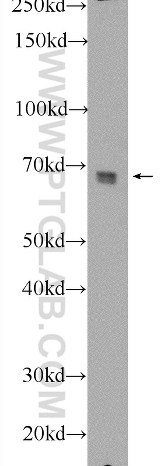 FRS2 Antibody in Western Blot (WB)