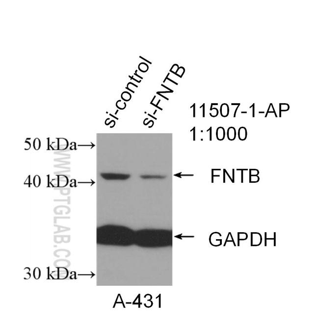 FNTB Antibody in Western Blot (WB)