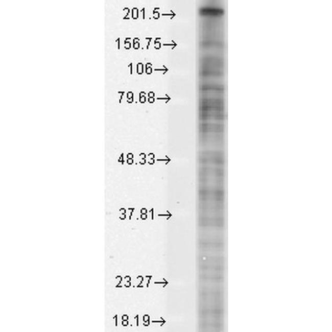 Nav1.8 Na+ Channel Antibody in Western Blot (WB)