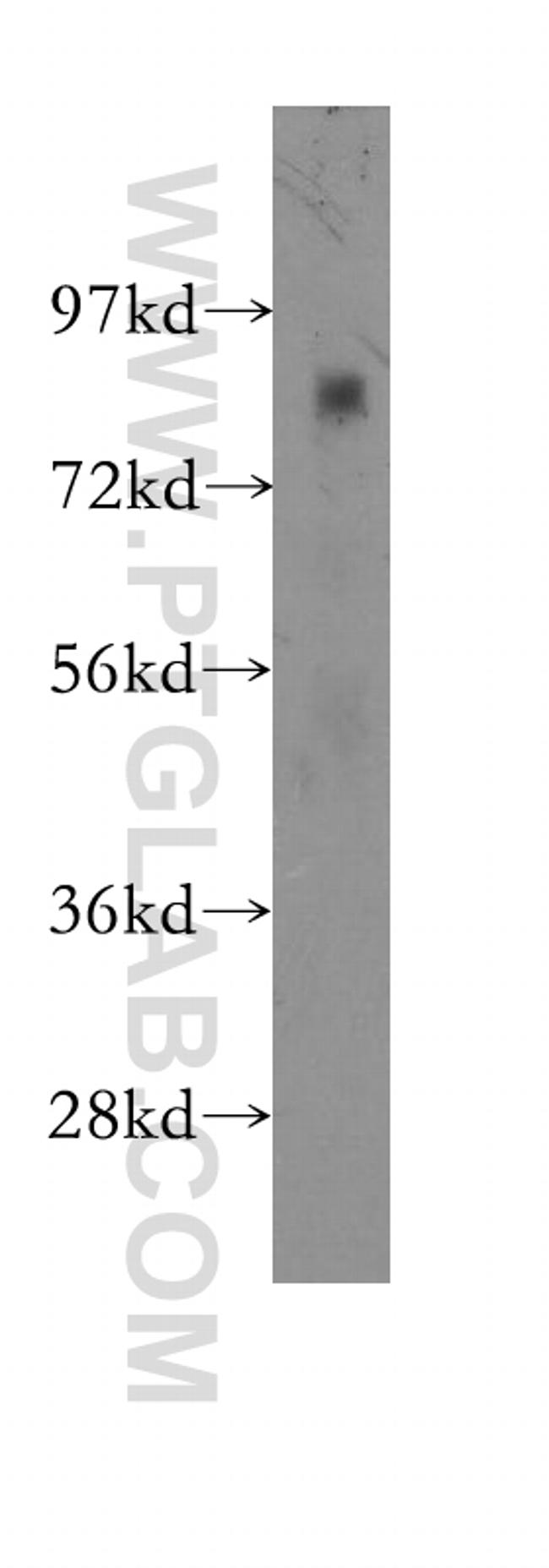 CHPF C-terminal Antibody in Western Blot (WB)