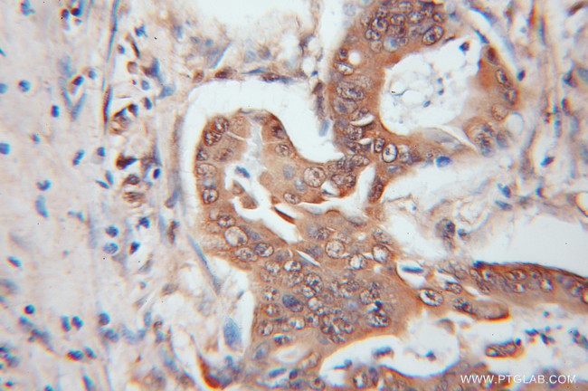 UCHL5 Antibody in Immunohistochemistry (Paraffin) (IHC (P))