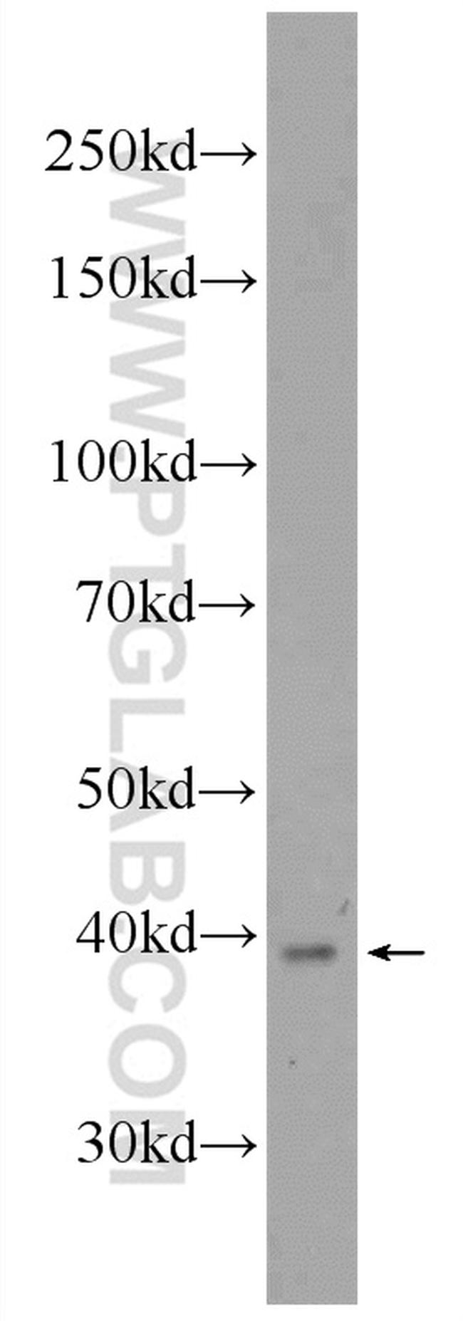 UCHL5 Antibody in Western Blot (WB)