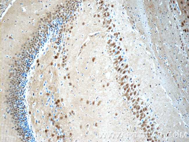 UCHL5 Antibody in Immunohistochemistry (Paraffin) (IHC (P))