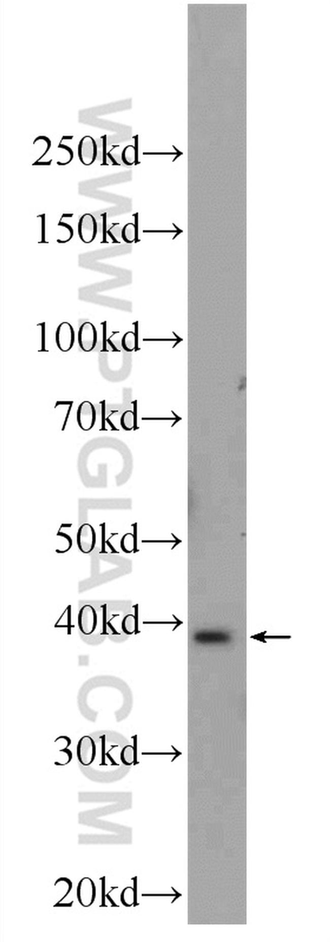 UCHL5 Antibody in Western Blot (WB)