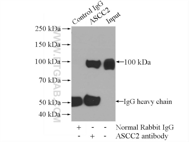 ASCC2 Antibody in Immunoprecipitation (IP)