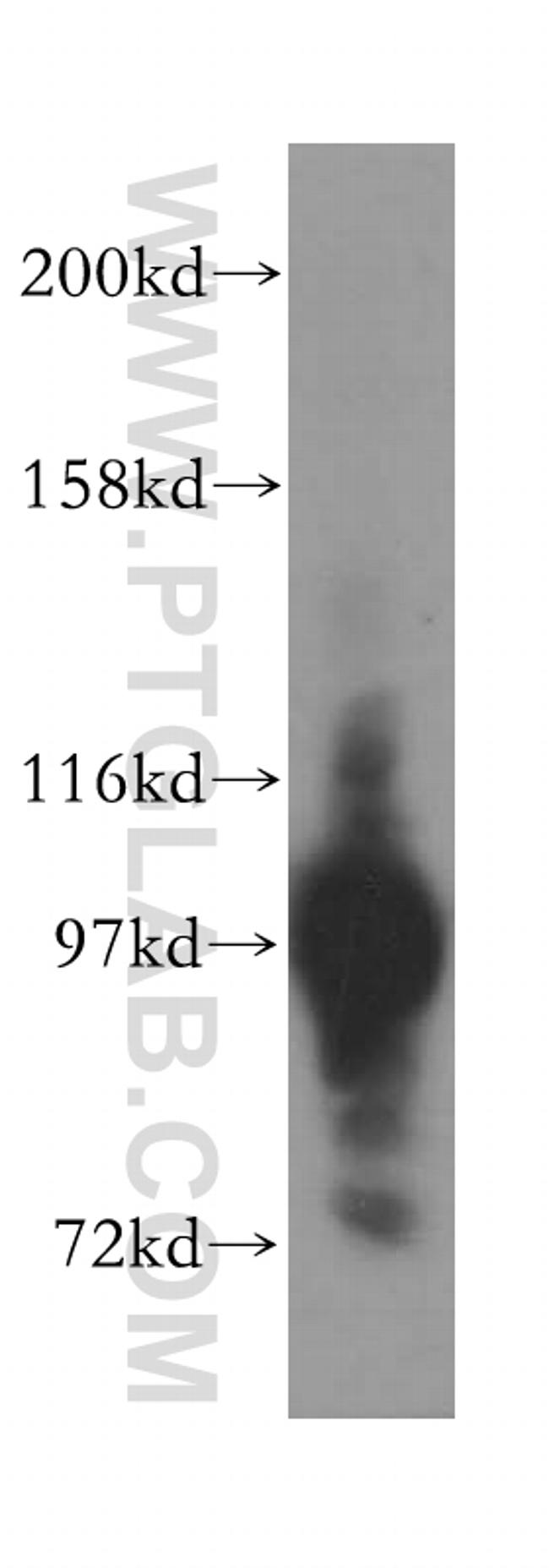 ASCC2 Antibody in Western Blot (WB)