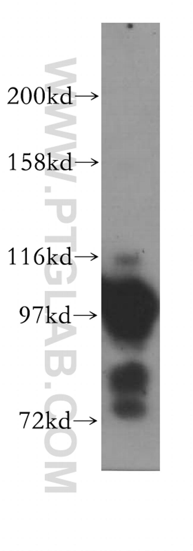 ASCC2 Antibody in Western Blot (WB)