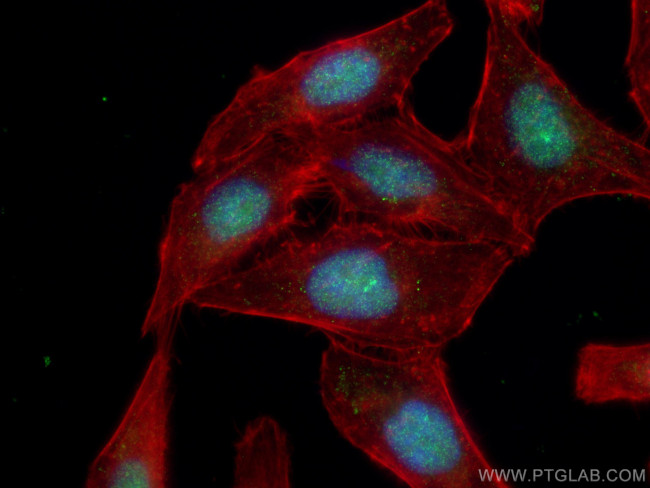 ORC5L Antibody in Immunocytochemistry (ICC/IF)