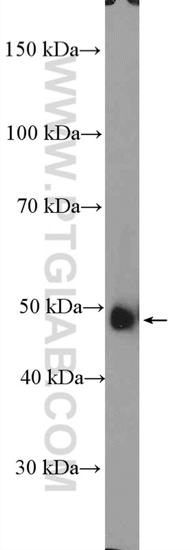 ORC5L Antibody in Western Blot (WB)