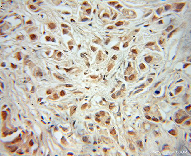 MEIS2 Antibody in Immunohistochemistry (Paraffin) (IHC (P))