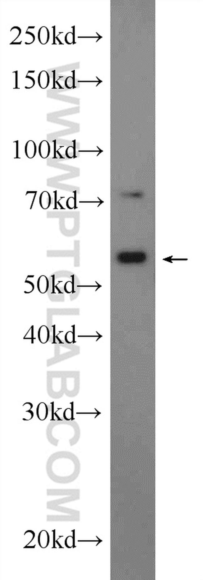 MEIS2 Antibody in Western Blot (WB)