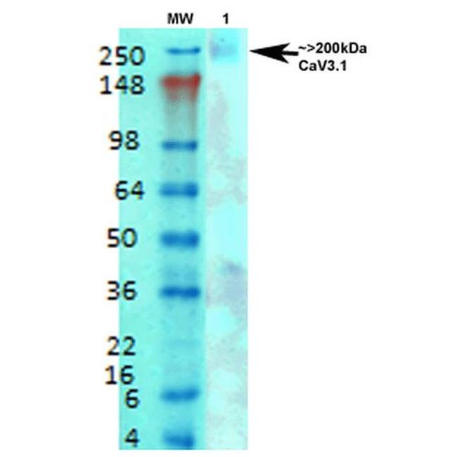 Cav3.1 Ca+2 Channel Antibody in Western Blot (WB)