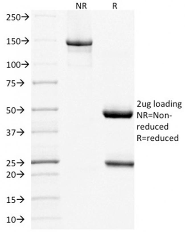 CD268/BAFFR/TNFRSF13C Antibody in SDS-PAGE (SDS-PAGE)