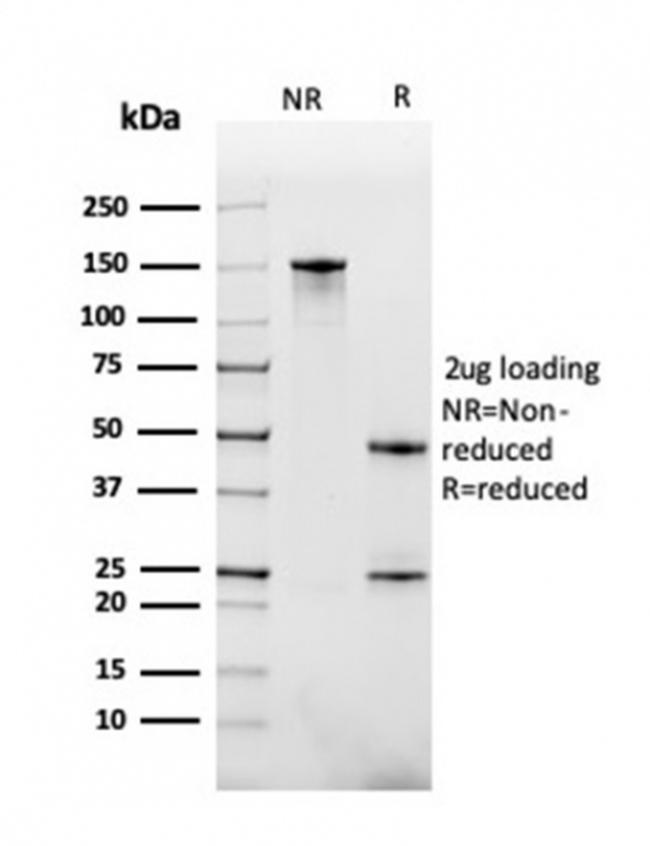 CD268/BAFFR/TNFRSF13C Antibody in SDS-PAGE (SDS-PAGE)