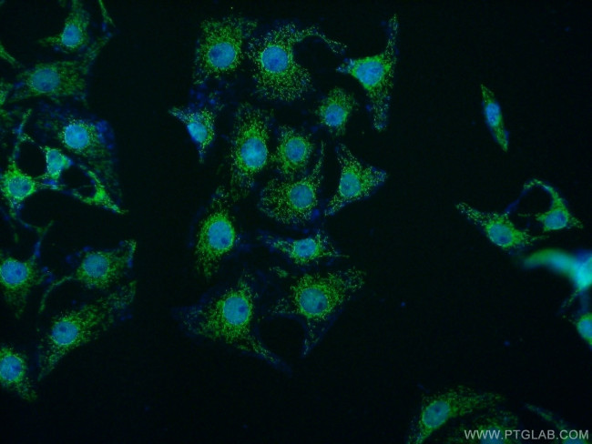 MED15 Antibody in Immunocytochemistry (ICC/IF)