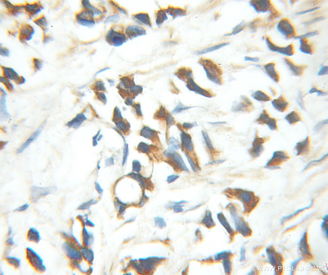 MED15 Antibody in Immunohistochemistry (Paraffin) (IHC (P))