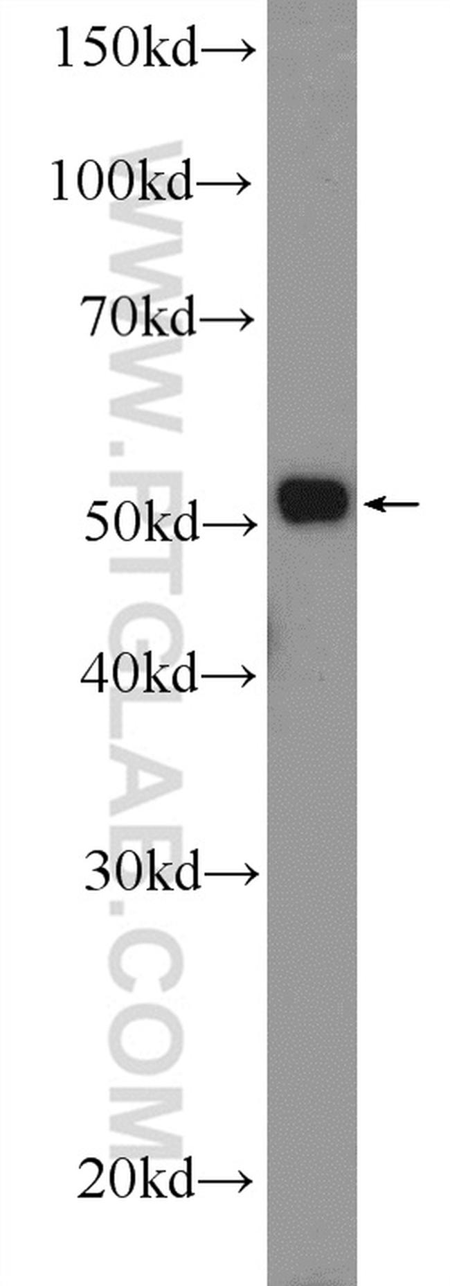 MTRF1 Antibody in Western Blot (WB)