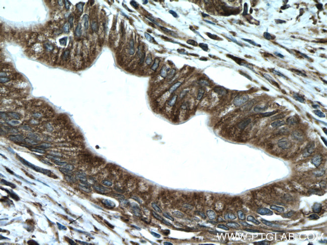 GRP78/BIP Antibody in Immunohistochemistry (Paraffin) (IHC (P))