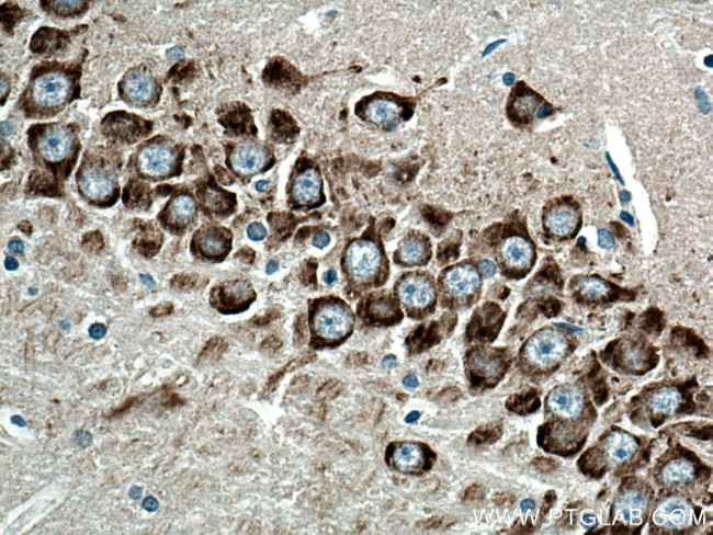 GRP78/BIP Antibody in Immunohistochemistry (Paraffin) (IHC (P))