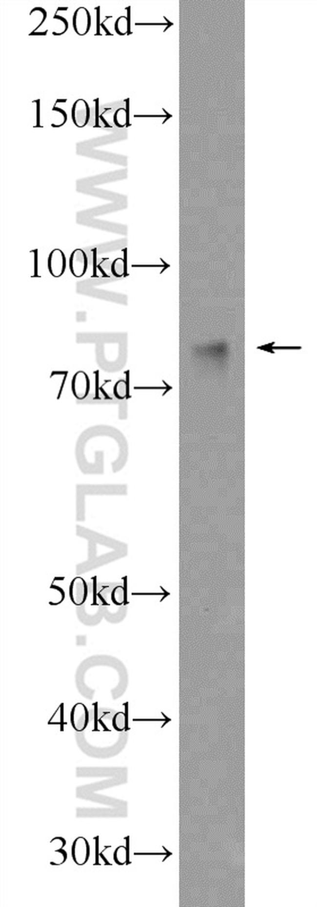 GRP78/BIP Antibody in Western Blot (WB)