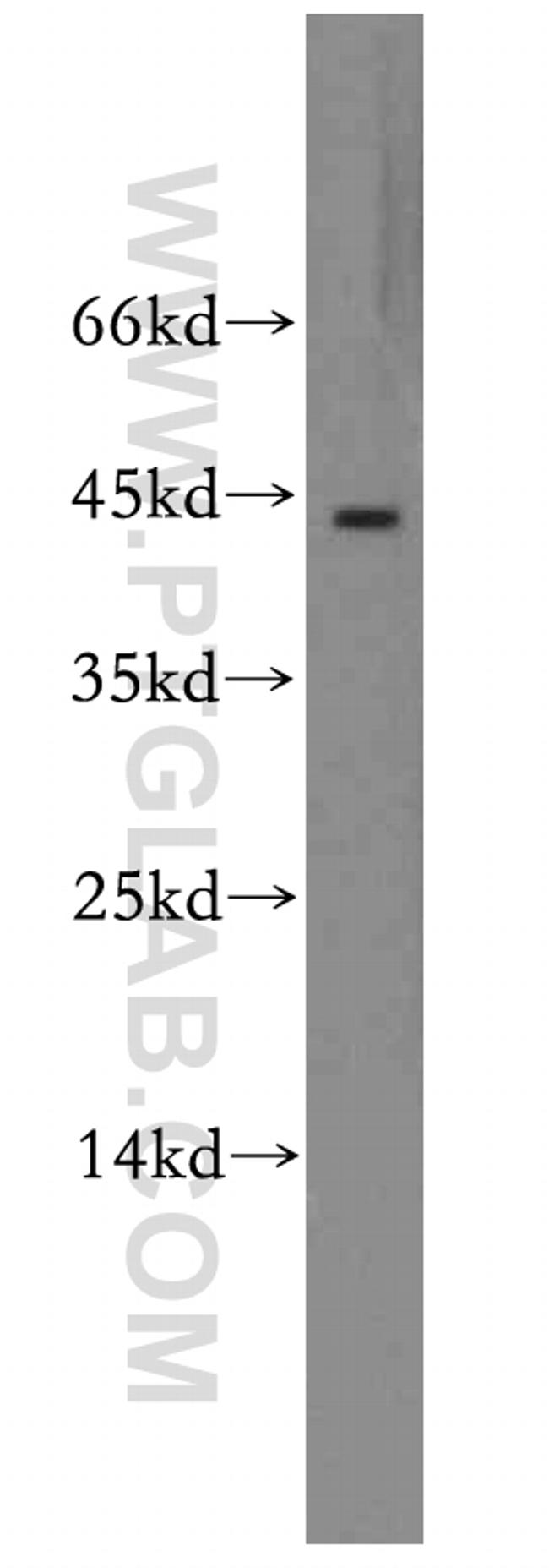 RGS5 Antibody in Western Blot (WB)
