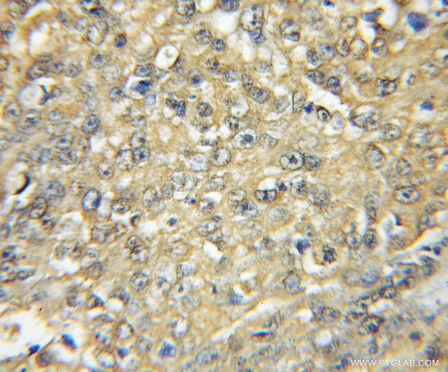 HCK Antibody in Immunohistochemistry (Paraffin) (IHC (P))