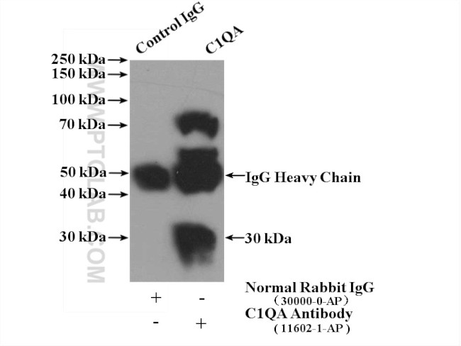 C1qA Antibody in Immunoprecipitation (IP)