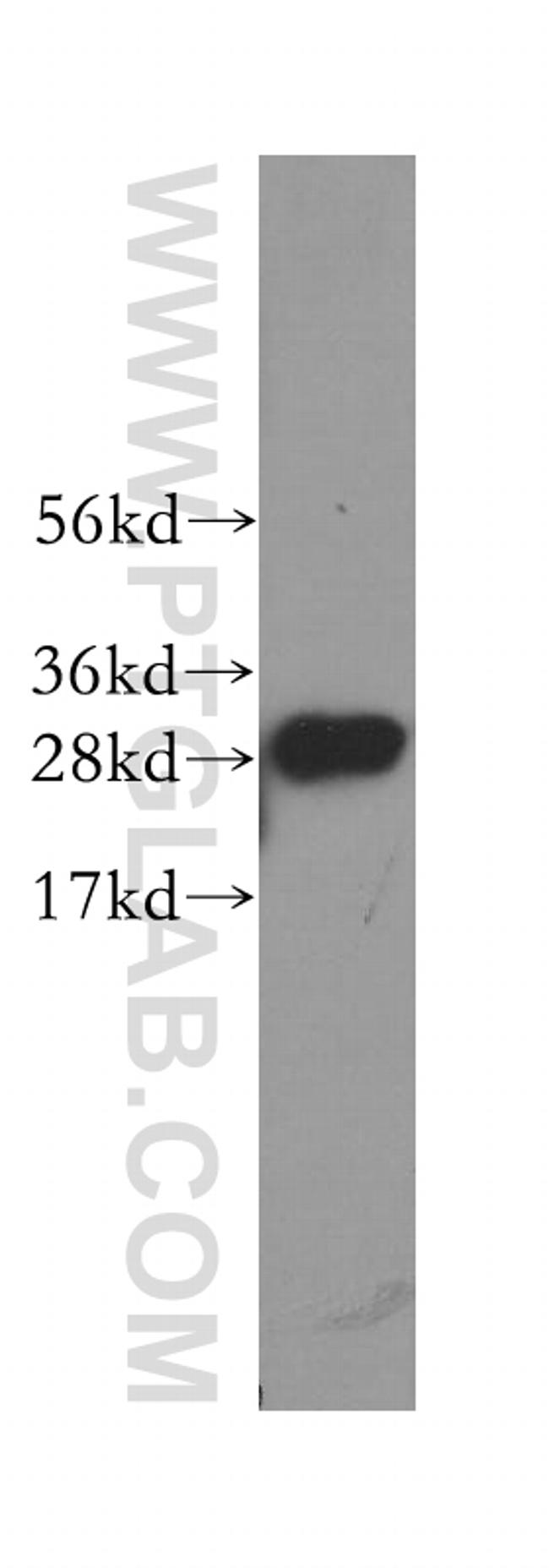 C1qA Antibody in Western Blot (WB)