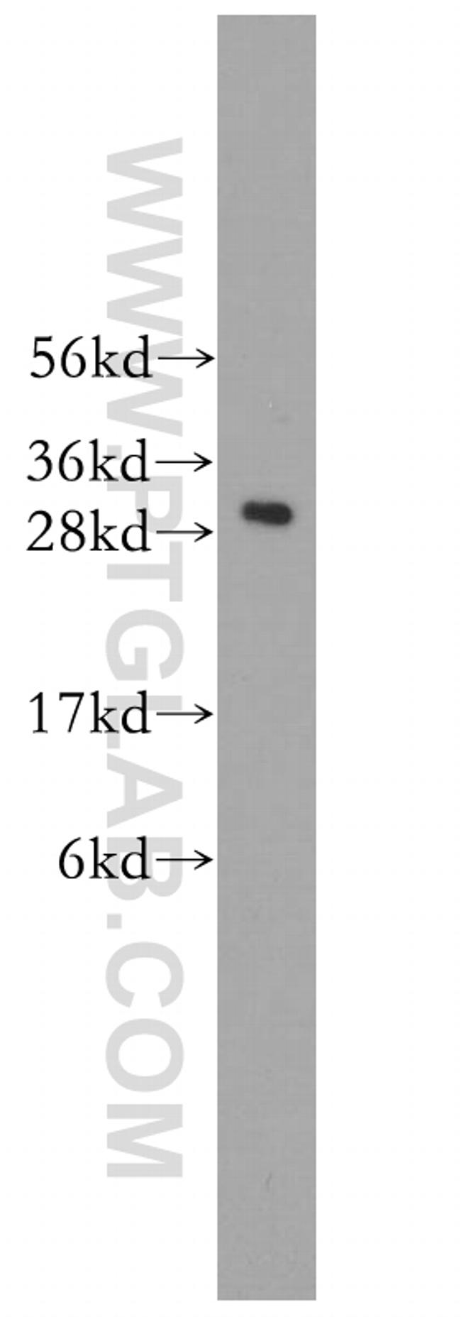 C1qA Antibody in Western Blot (WB)