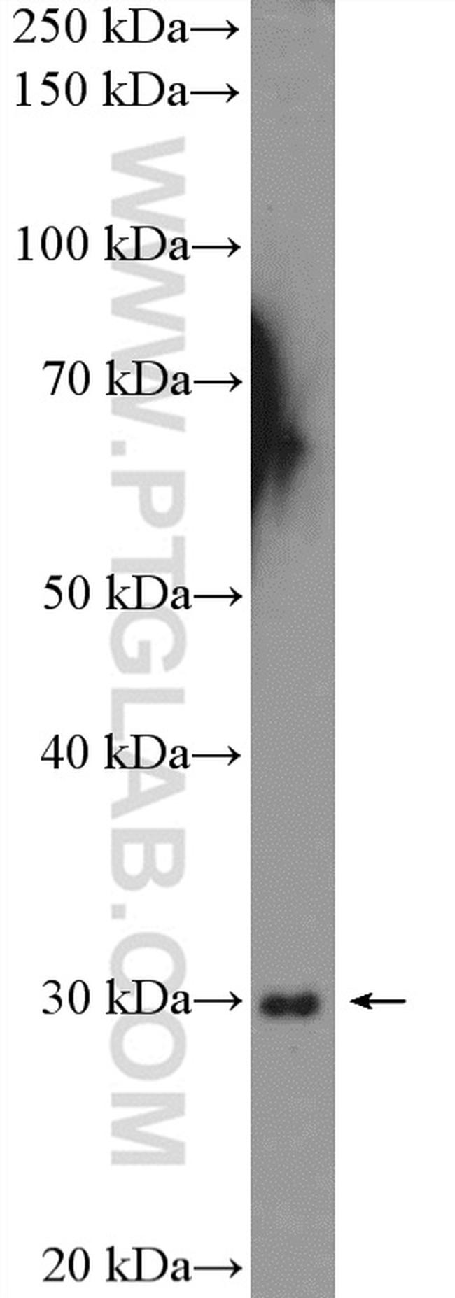 C1qA Antibody in Western Blot (WB)