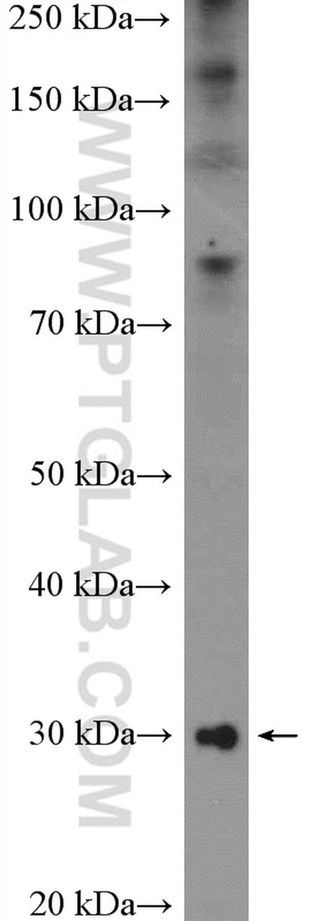 C1qA Antibody in Western Blot (WB)