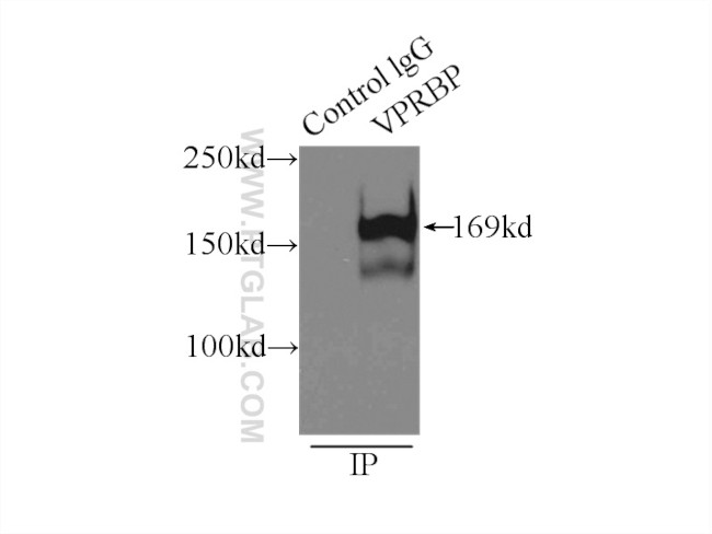 VPRBP Antibody in Immunoprecipitation (IP)