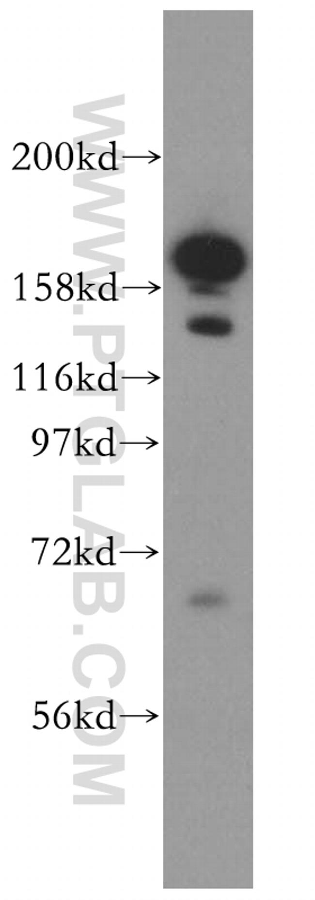 VPRBP Antibody in Western Blot (WB)