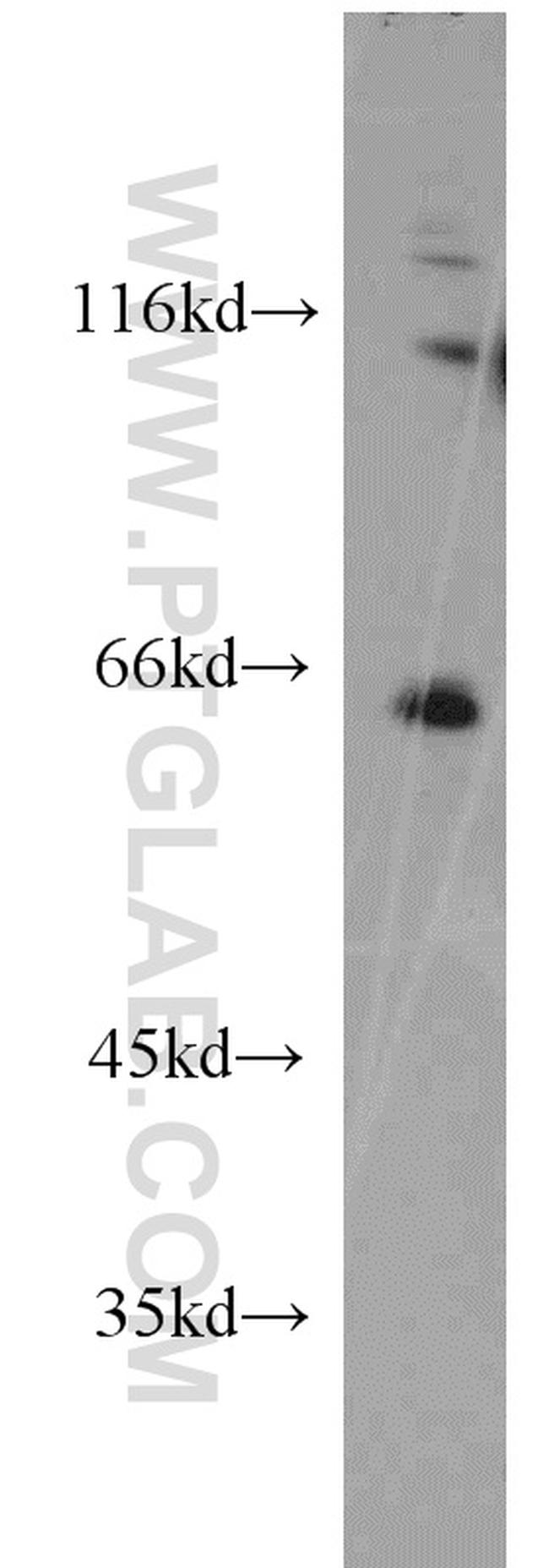 NEIL3 Antibody in Western Blot (WB)