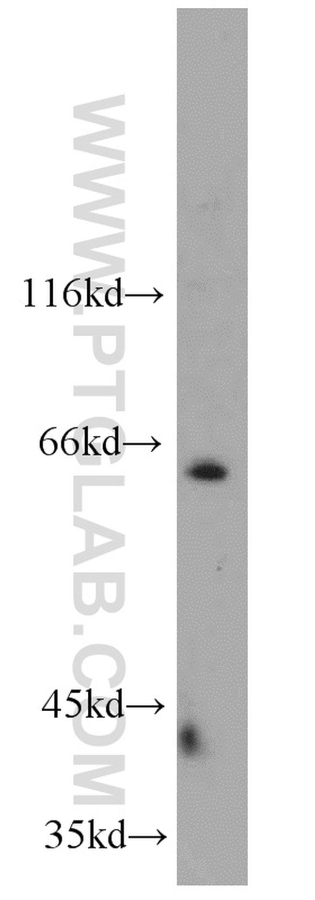 NEIL3 Antibody in Western Blot (WB)