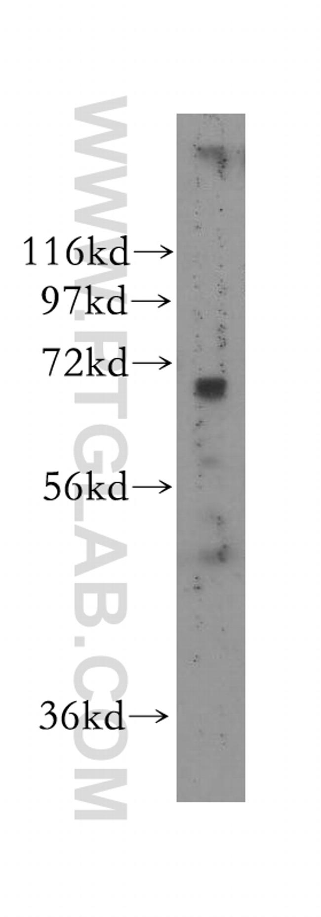 NEIL3 Antibody in Western Blot (WB)