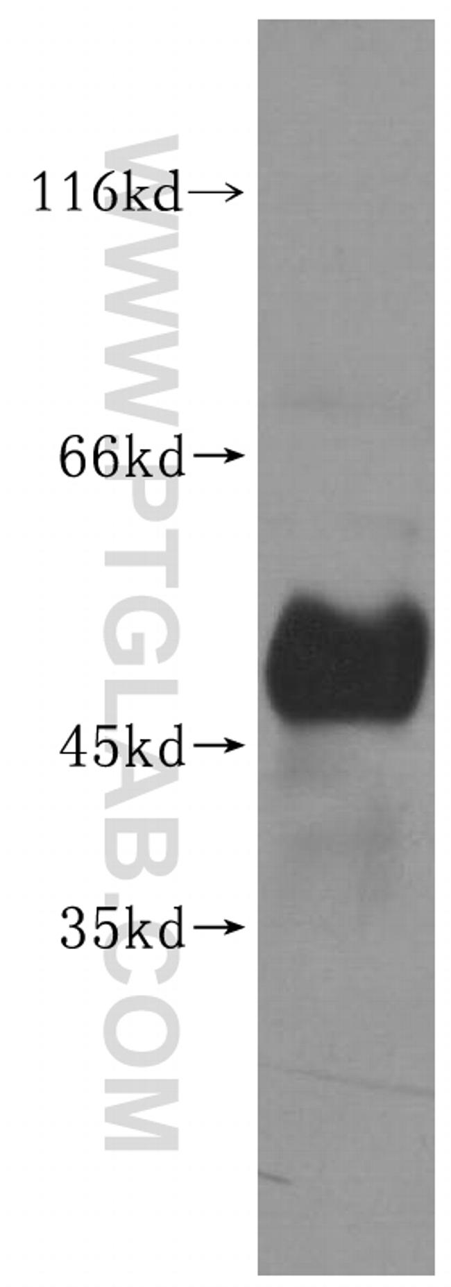 UHMK1 Antibody in Western Blot (WB)