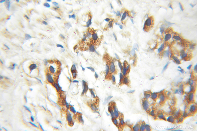 ENTPD6 Antibody in Immunohistochemistry (Paraffin) (IHC (P))