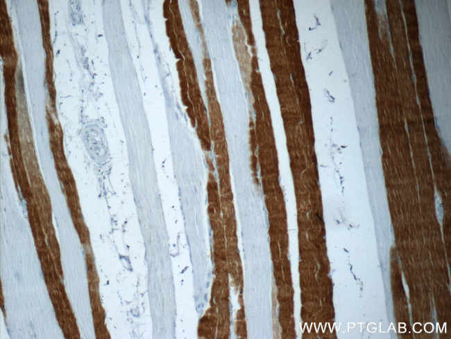 TNNI2 Antibody in Immunohistochemistry (Paraffin) (IHC (P))