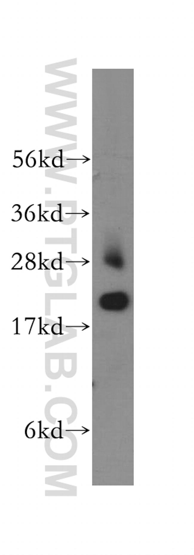 TNNI2 Antibody in Western Blot (WB)